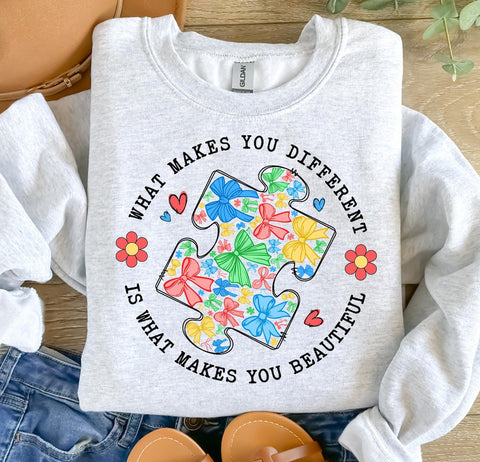 What makes you different is what makes you beautiful